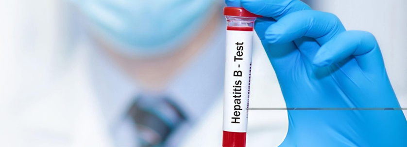 Hepatitis B