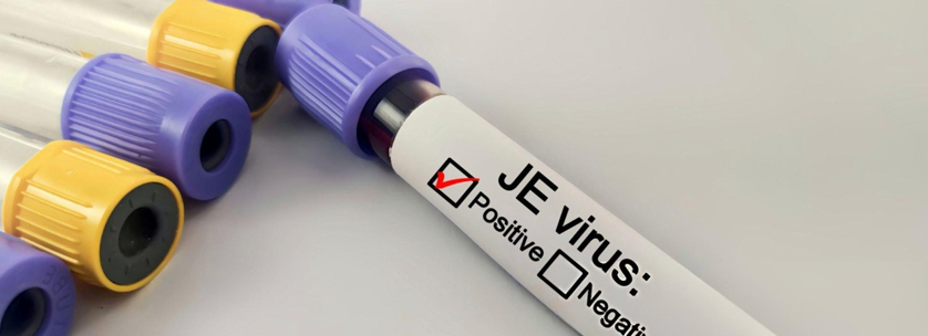 Japanese Encephalitis