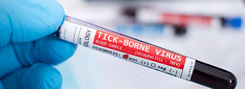 Tick-Borne Encephalitis