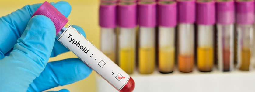 Typhoid